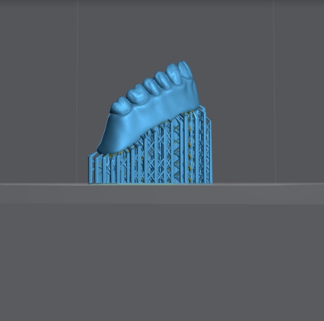 Angled nightguard with supports